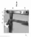 Fig. 08 - Orthopedic tools for implantation