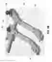 Fig. 09 - Orthopedic tools for implantation