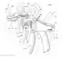 Fig. 06 - Assemblies for use in knee replacement surgery