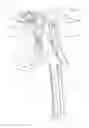 Fig. 12 - Assemblies for use in knee replacement surgery