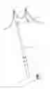 Fig. 01 - Method of Performing a Mastopexy Procedure