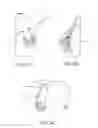 Fig. 05 - Method of Performing a Mastopexy Procedure