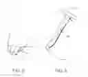 Fig. 06 - Method of Performing a Mastopexy Procedure