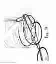 Fig. 14 - Suture stitches for continuous surgical suturing