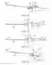 Fig. 04 - Medical implement for manipulating sutures particularly useful in arthroscopic surgery