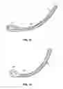 Fig. 12 - SUTURE