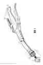 Fig. 02 - Surgical stapling apparatus including buttress attachment via tabs