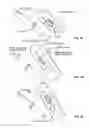 Fig. 06 - CLOSURE DEVICE AND METHOD