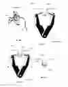 Fig. 43 - CLOSURE DEVICE AND METHOD