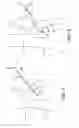 Fig. 03 - METHOD AND APPARATUS FOR TREATING VARICOSE VEINS