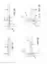 Fig. 10 - METHOD AND APPARATUS FOR TREATING VARICOSE VEINS