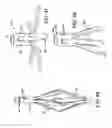 Fig. 18 - METHOD AND APPARATUS FOR TREATING VARICOSE VEINS