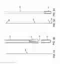 Fig. 20 - METHOD AND APPARATUS FOR TREATING VARICOSE VEINS