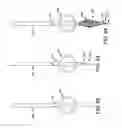 Fig. 23 - METHOD AND APPARATUS FOR TREATING VARICOSE VEINS