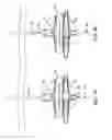 Fig. 31 - METHOD AND APPARATUS FOR TREATING VARICOSE VEINS
