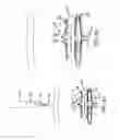 Fig. 32 - METHOD AND APPARATUS FOR TREATING VARICOSE VEINS