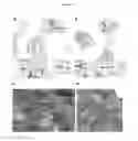 Fig. 20 - Pneumatic tourniquet