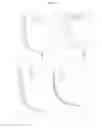 Fig. 56 - Pneumatic tourniquet