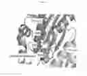 Fig. 64 - Pneumatic tourniquet