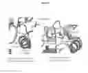 Fig. 65 - Pneumatic tourniquet