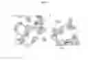 Fig. 78 - Pneumatic tourniquet