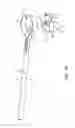 Fig. 02 - System for articular surface replacement