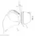 Fig. 06 - System for articular surface replacement