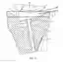 Fig. 12 - System for articular surface replacement
