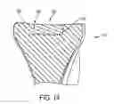Fig. 15 - System for articular surface replacement