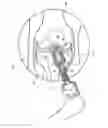 Fig. 01 - ASSEMBLY FOR LIGAMENT REPAIR AND INCLUDING A CUTTING TOOL