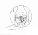 Fig. 04 - ASSEMBLY FOR LIGAMENT REPAIR AND INCLUDING A CUTTING TOOL