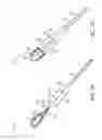 Fig. 04 - Device for removing kidney stones