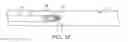 Fig. 09 - Device for removing kidney stones