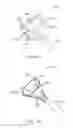 Fig. 13 - Device for removing kidney stones