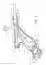Fig. 10 - Uterine fibroid tissue removal device