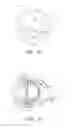 Fig. 13 - Uterine fibroid tissue removal device