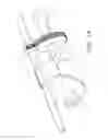 Fig. 21 - Uterine fibroid tissue removal device