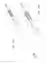 Fig. 24 - Uterine fibroid tissue removal device