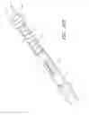 Fig. 26 - Uterine fibroid tissue removal device