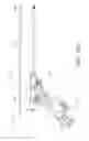 Fig. 29 - Uterine fibroid tissue removal device