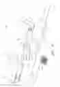 Fig. 32 - Uterine fibroid tissue removal device
