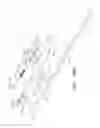 Fig. 34 - Uterine fibroid tissue removal device