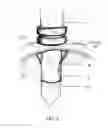 Fig. 10 - SAFETY CANNULA