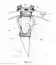 Fig. 12 - SAFETY CANNULA