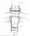 Fig. 14 - SAFETY CANNULA