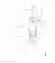 Fig. 03 - DEVICE FOR EXTRACTING ELEMENTS FROM A CAVITY