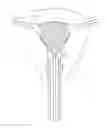 Fig. 01 - METHOD AND DEVICE FOR DISTENDING A GYNECOLOGICAL CAVITY