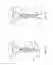 Fig. 45 - METHOD AND DEVICE FOR DISTENDING A GYNECOLOGICAL CAVITY