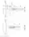 Fig. 49 - METHOD AND DEVICE FOR DISTENDING A GYNECOLOGICAL CAVITY