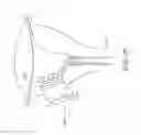 Fig. 55 - METHOD AND DEVICE FOR DISTENDING A GYNECOLOGICAL CAVITY